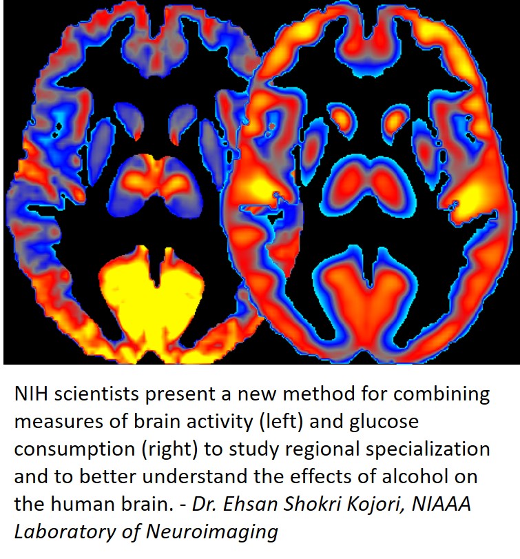 Brain imaging used by NIH scientists to improve our understanding of how alcohol affects the brain