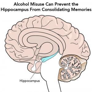 alcohol misuse can prevent the hippocampus from consolidating memories