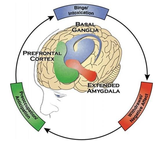 Three Stages of the Addiction Cycle, Brain Regions Associated with Addiction, the basal ganglia is associated with the binge intoxication stage, the extended amygdala is associated with the withdrawal negative affect stage, the prefrontal cortex is associated with the preoccupation anticipation stage.