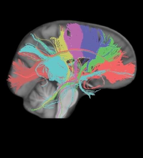 image of the brain