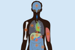 A silhouette of a body with color coded organs inside